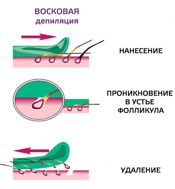 Чем смыть воск после депиляции